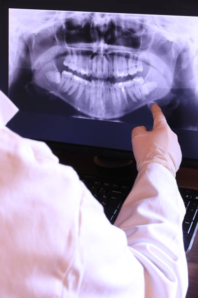 Best Emergency Root Canal Treatment in Icard, NC