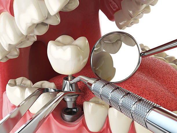 Best Mobile Emergency Dentist in Icard, NC
